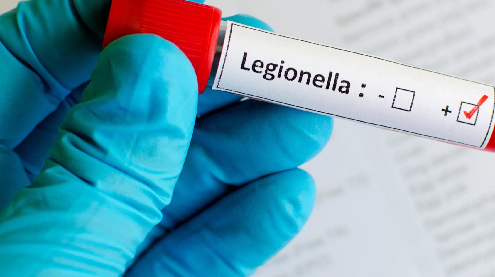 Análisis positivo de legionella en instalación de Ibiza